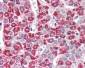 MCAD / ACADM Antibody (C-Terminus)